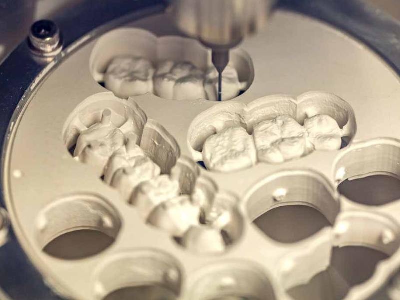 Odontologia digital: o que é e suas vantagens