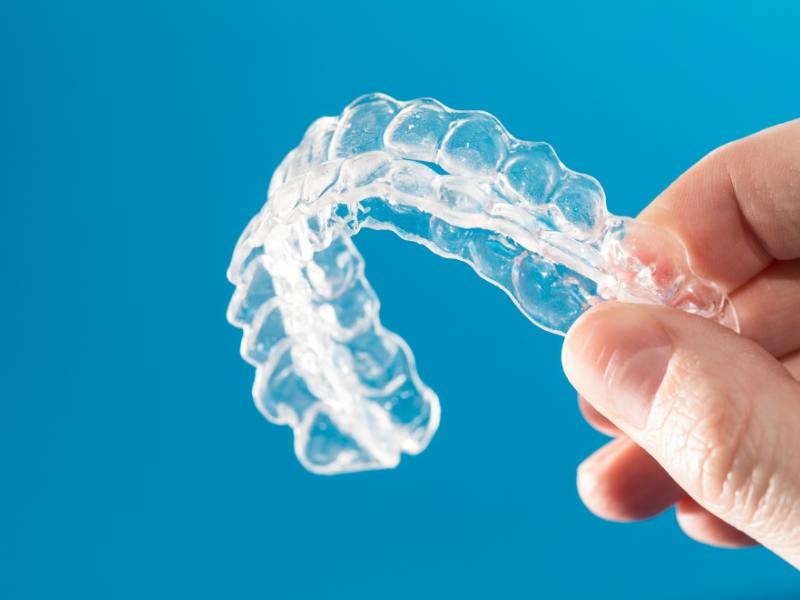 Invisalign, o que é? Tempo de tratamento?