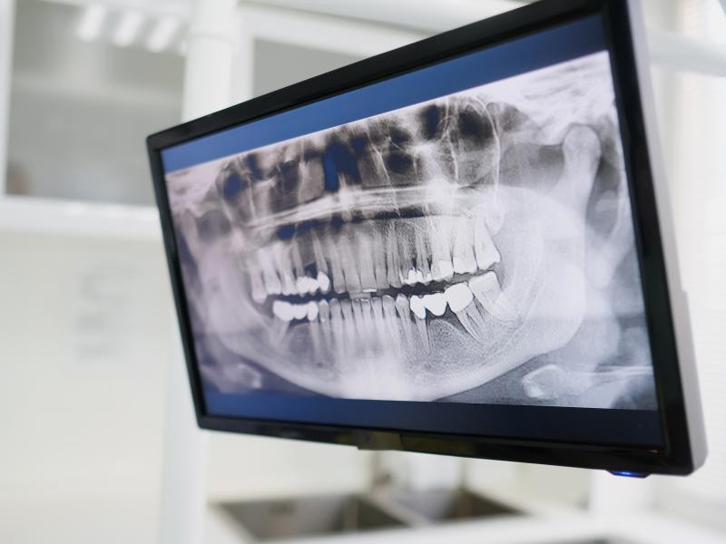 Ortodontia Moderna e Digital: Como a Tecnologia Facilita o seu Sorriso