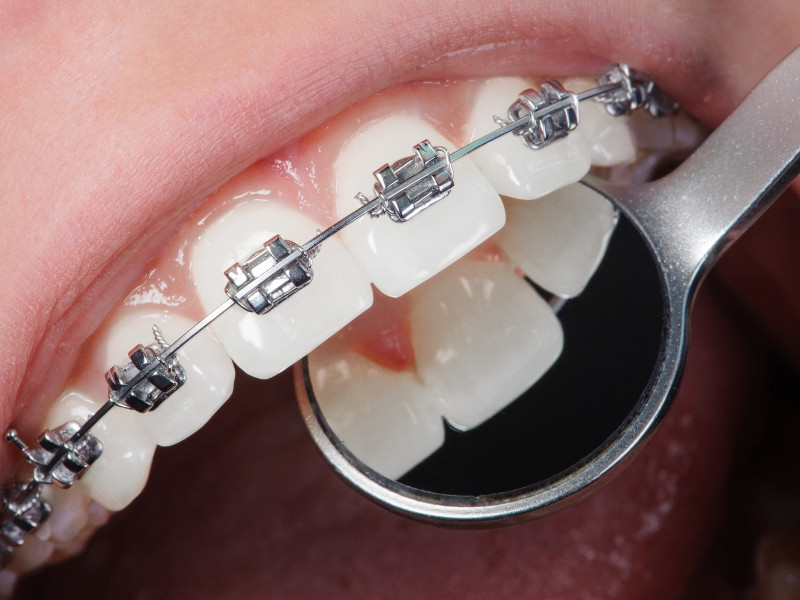 Consulta de Medicina Dentária para Ortodontia