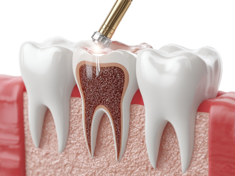 Consulta de Medicina Dentária para Restaurações Dentárias